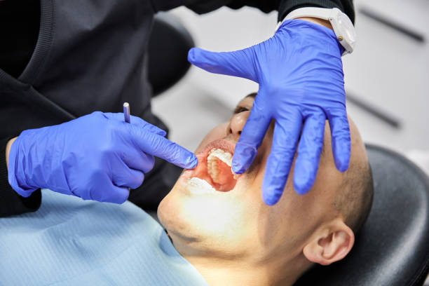 Best Emergency Dental Care for Broken or Chipped Teeth in Montclair State University, NJ